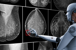 Artificial intelligence in radiology